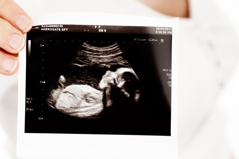 Where To Get a Local Prenatal Ultrasound in Northern Colorado and the Denver Area